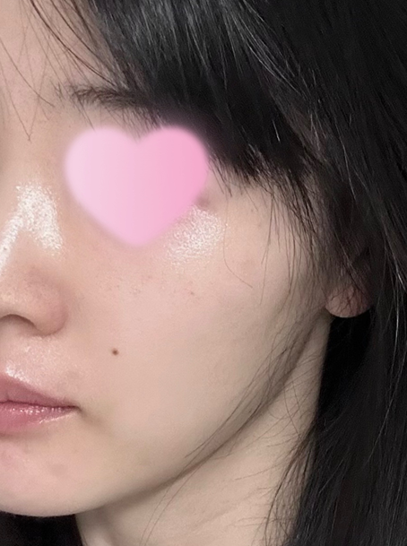 앰플 사용 후 나의 피부상태 사진