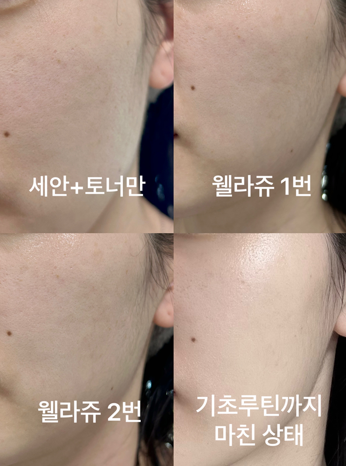 앰플 사용 4단계 사진