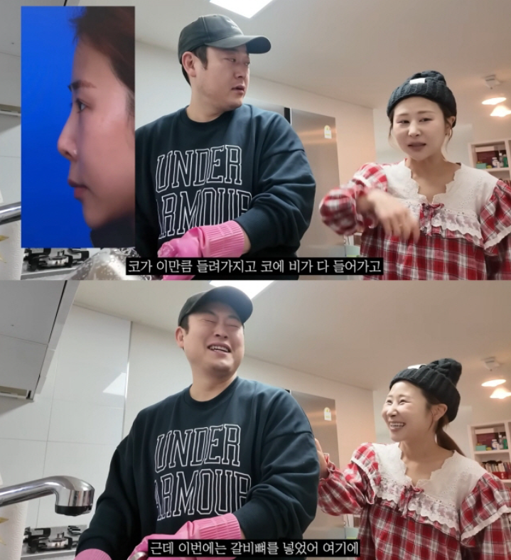 박세미 코 구축 관련 유튜브 캡처