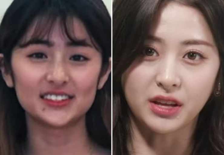 허윤진 얼굴형 관리 전,후