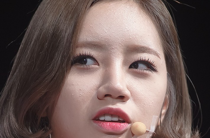 좁쌀여드름 난 혜리