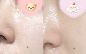 모공 탄력 패드 일주일 사용 효과