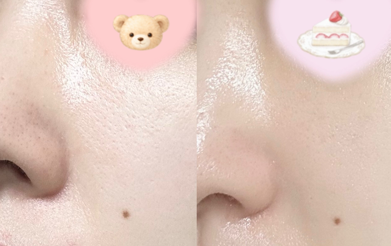 모공 탄력 패드 일주일 사용 효과